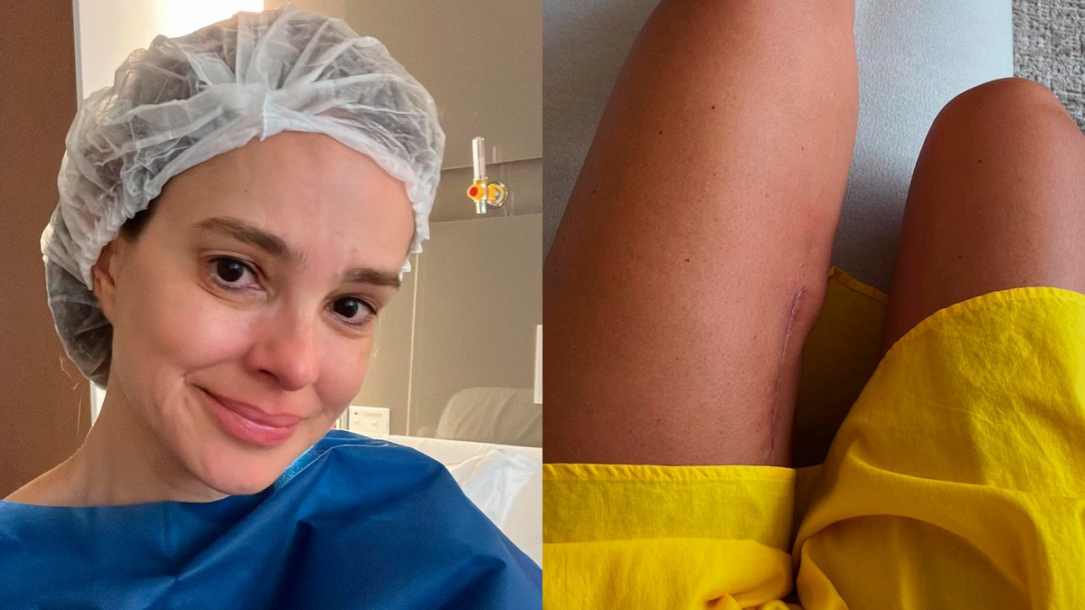 Quase no fim da radioterapia, Vera Viel fala de mais uma etapa do tratamento após a retirada de tumor